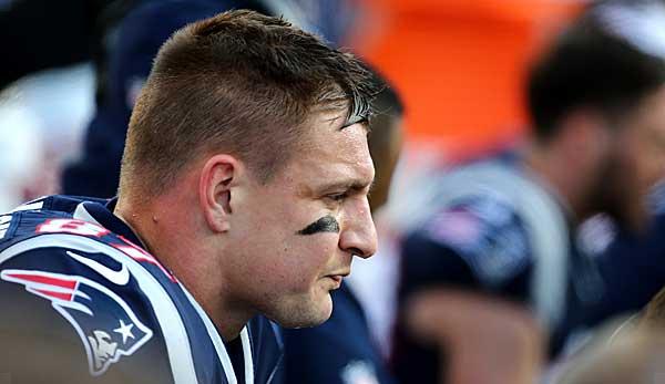 NFL: Brain concussion: Patriots fear Super Bowl for Gronkowski