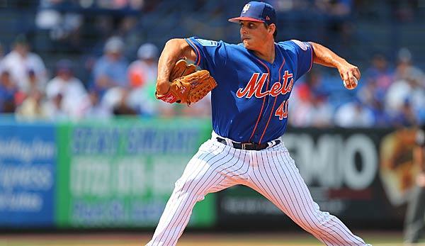 MLB: New York Mets: Left-handed Jason Vargas breaks his right hand