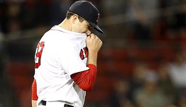 MLB: Sox-Pitcher injures his shoulder while throwing a glove